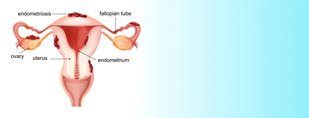 Structural & Reproductive Issues Index